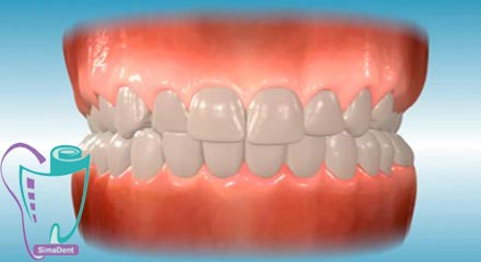 کراس‌بایت
