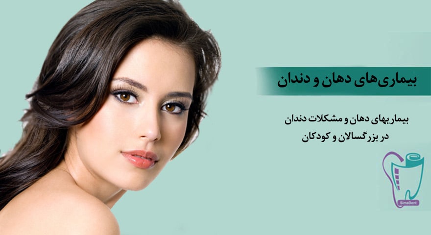 بیماریهای دهان و مشکلات دندان در بزرگسالان و کودکان