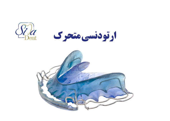 ارتودنسی متحرک