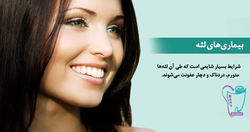 بیماری های لثه