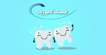 فیسینگ کامپوزیت