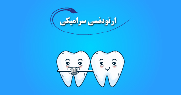 ارتودنسی سرامیکی