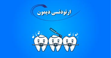 ارتودنسی دیمون