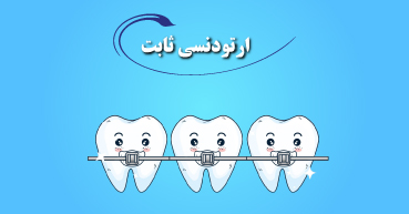 ارتودنسی ثابت