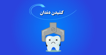 کشیدن دندان