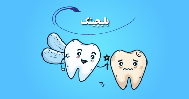 بلیچینگ دندان