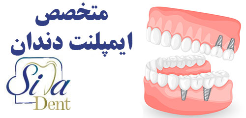بهترین متخصص ایمپلنت دندان