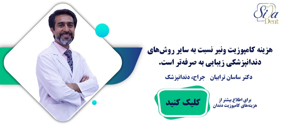 هزینه کامپوزیت دندان