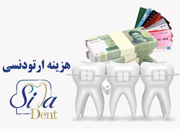 تصویر شاخص هزینه ارتودنسی