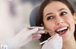 ویژگی های متخصص لمینت دندان 2