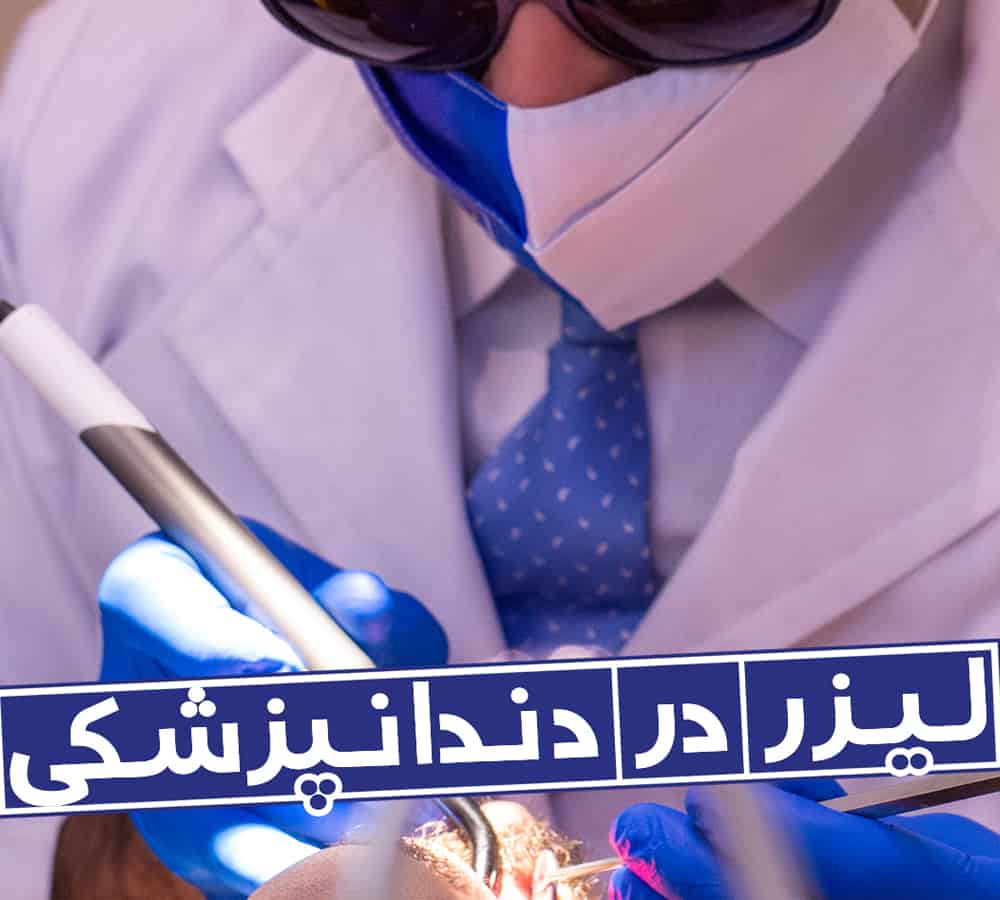 باسلام. بنده قرص پلاویکس مصرف میکنم و میخواهم دندان بکشم البته با لیزر که هم خونریزی نداشته باشد و هم درد کمتر. لطفا راهنمایی بفرمایید. 1 Laser in dentistry