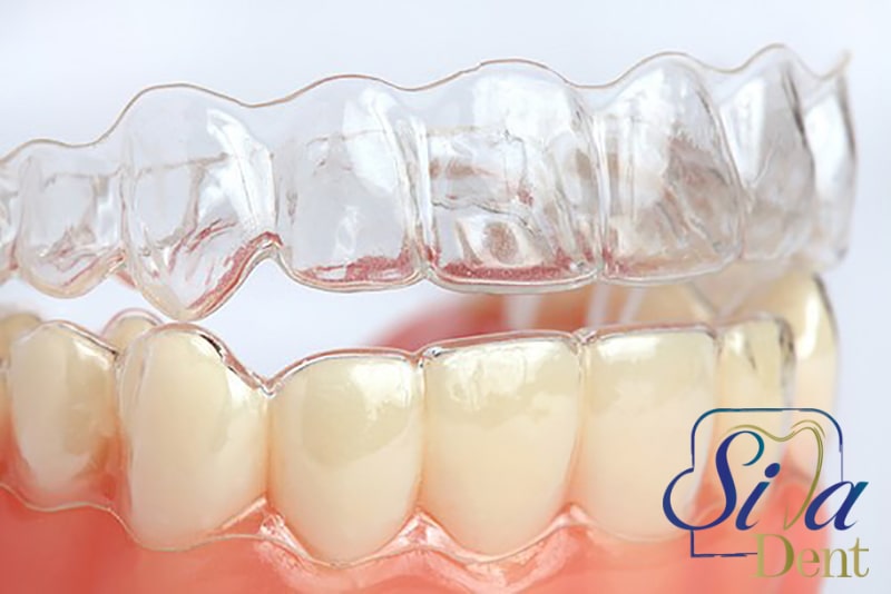 ارتودنسی نامرئی در کلینیک دندانپزشکی سیمادنت