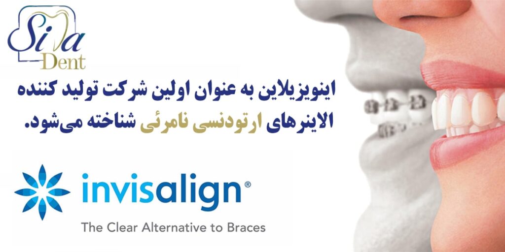 استفاده از ارتودنسی نامرئی اینویلاین در سیمادنت