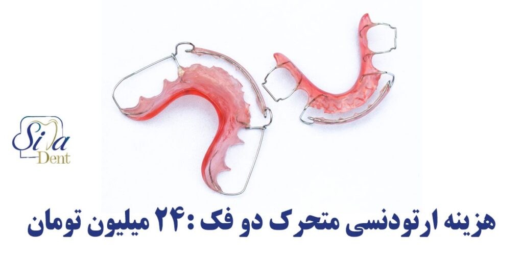 هزینه ارتودنسی متحرک 24 میلیون تومان به ازای هر فک خواهد بود