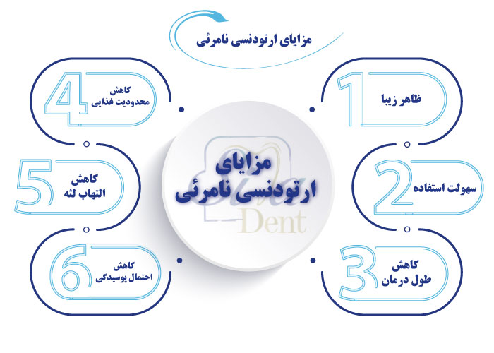ارتودنسی نامرئی