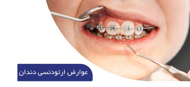 عوارض ارتودنسی دندان