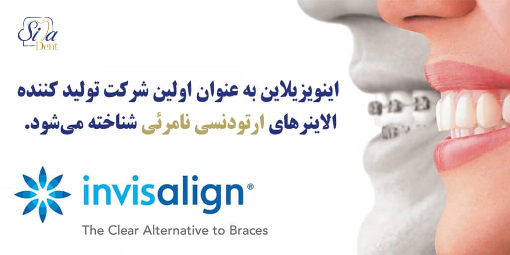 invisalign-company