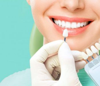 مقایسه هزینه ارتودنسی با لمینت