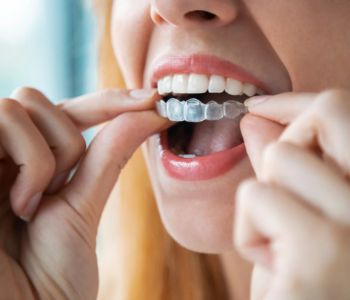 ارتودنسی نامرئی (مزایا و معایب الاینر شفاف) 11 مراقبت از ارتودنسی نامرئی اینویزیلاین