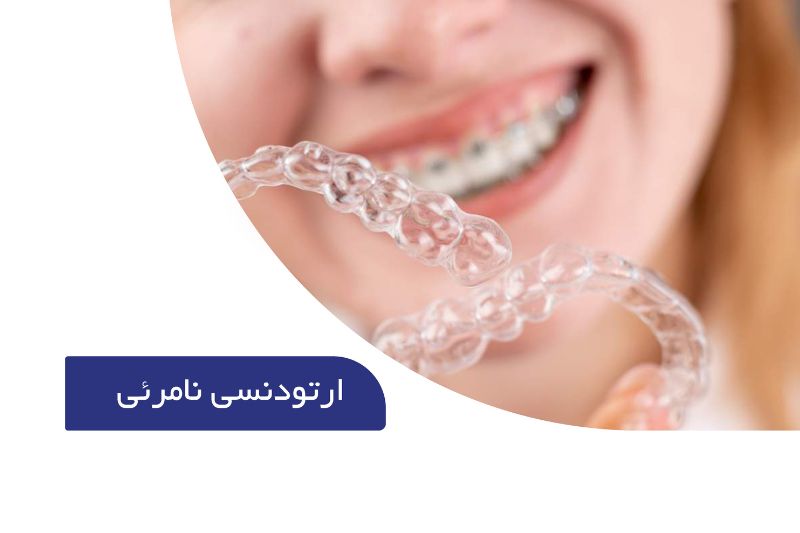 ارتودنسی نامرئی (مزایا و معایب الاینر شفاف) 1 ارتودنسی نامرئی
