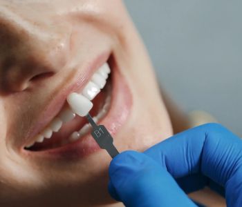 طول عمر انواع کامپوزیت 