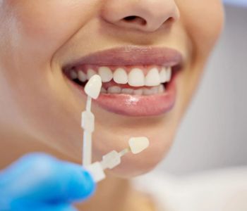 علائم پایان عمر کامپوزیت دندان