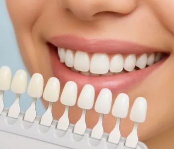 مزایای کامپوزیت در مقابل ارتودنسی