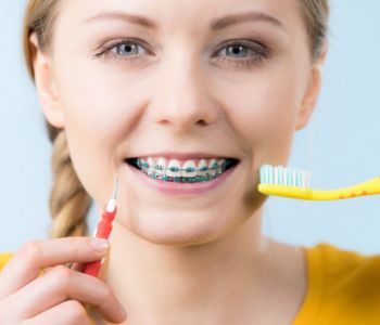 تفاوت مراقبت از ارتودنسی و کامپوزیت