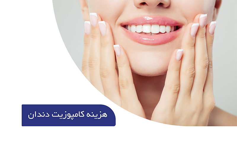 هزینه کامپوزیت دندان
