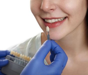 تفاوت هزینه ارتودنسی و کامپوزیت 