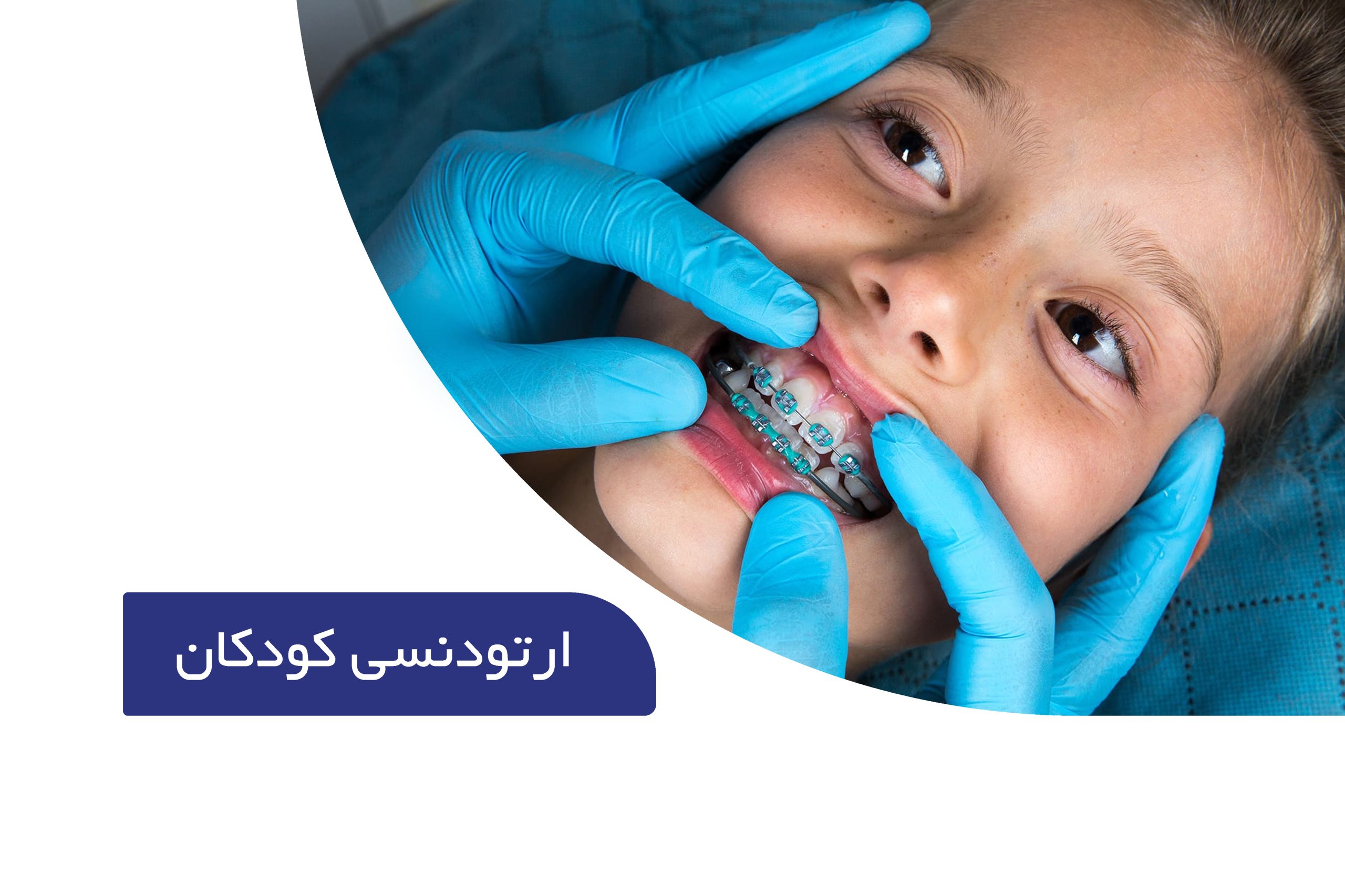 ارتودنسی کودکان (کاملترین راهنما برای والدین) 1 ارتودنسی دندان های کودکان