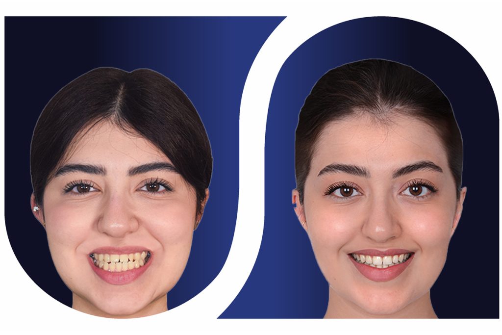 ارتودنسی و جراحی فک