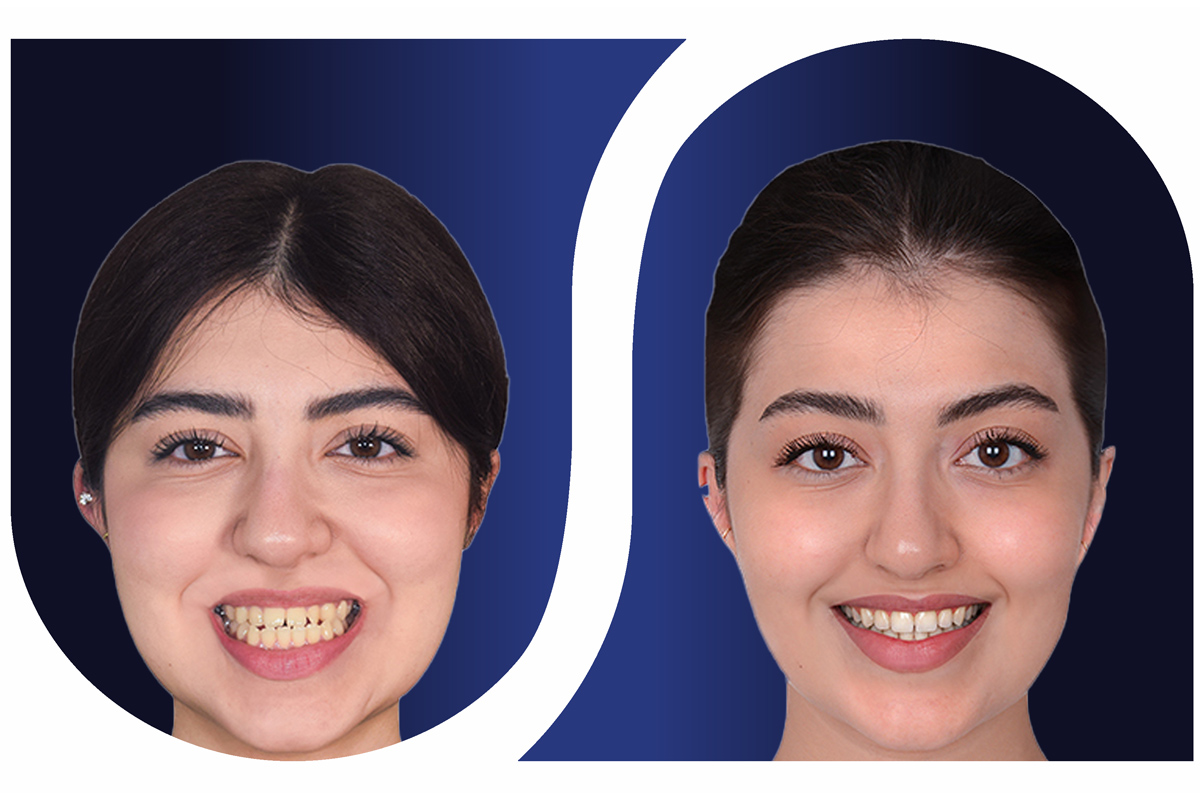 ارتودنسی و جراحی فک