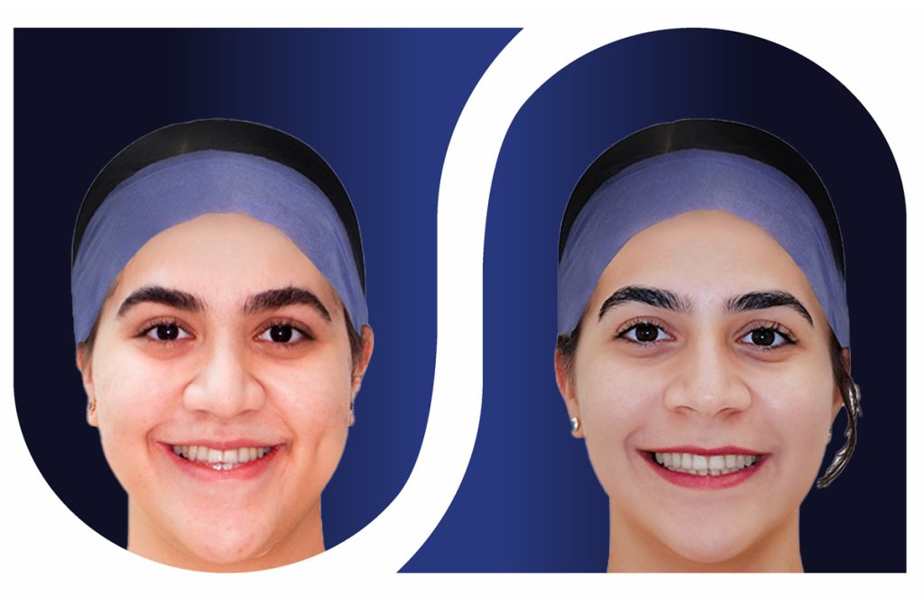 ارتودنسی و جراحی فک