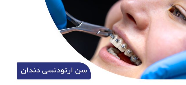 سن مناسب ارتودنسی دندان ها