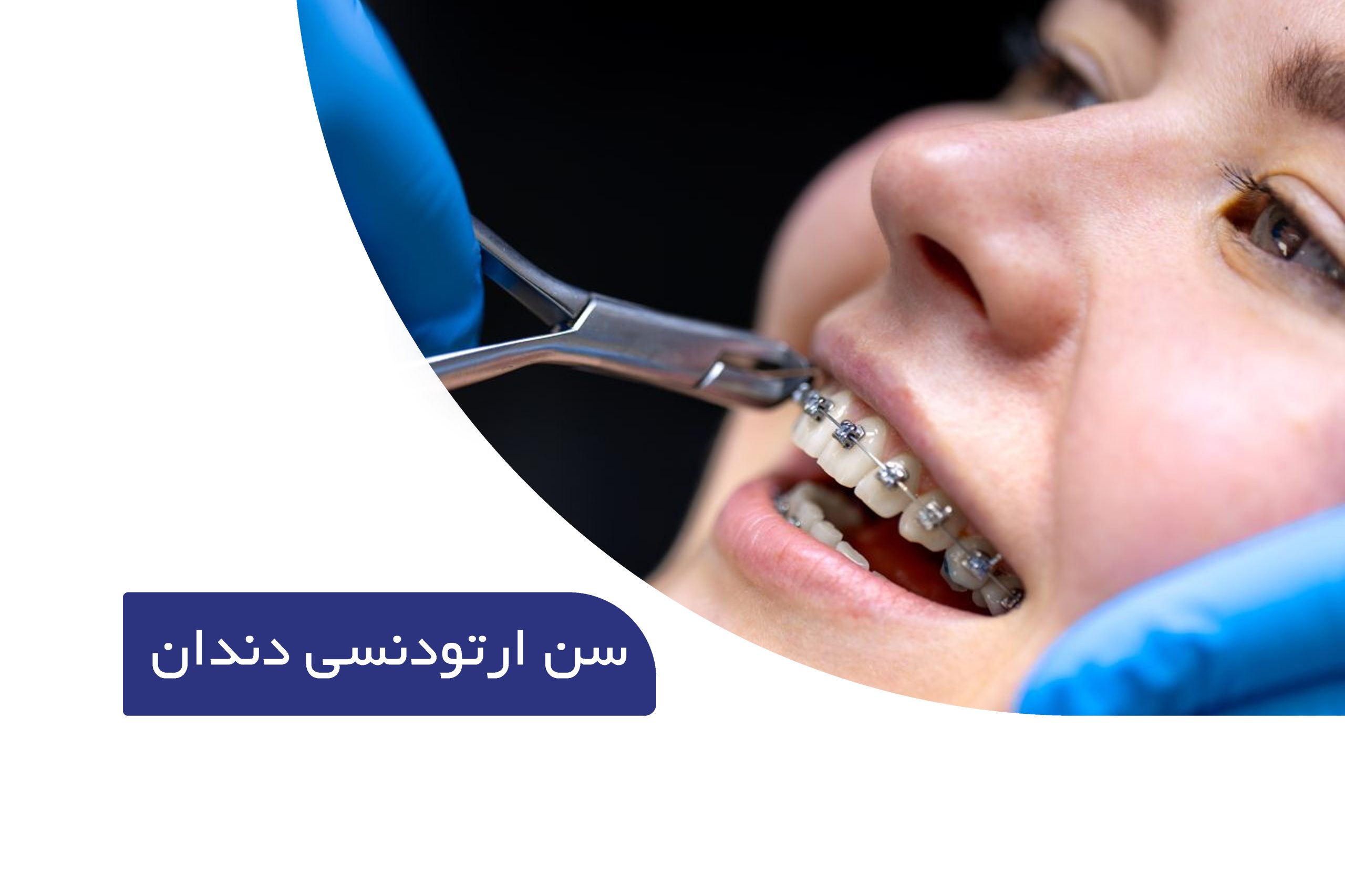سن مناسب ارتودنسی دندان ها