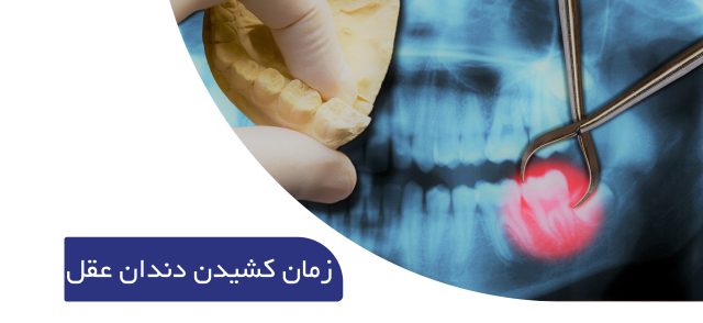زمان مناسب برای کشیدن دندان عقل