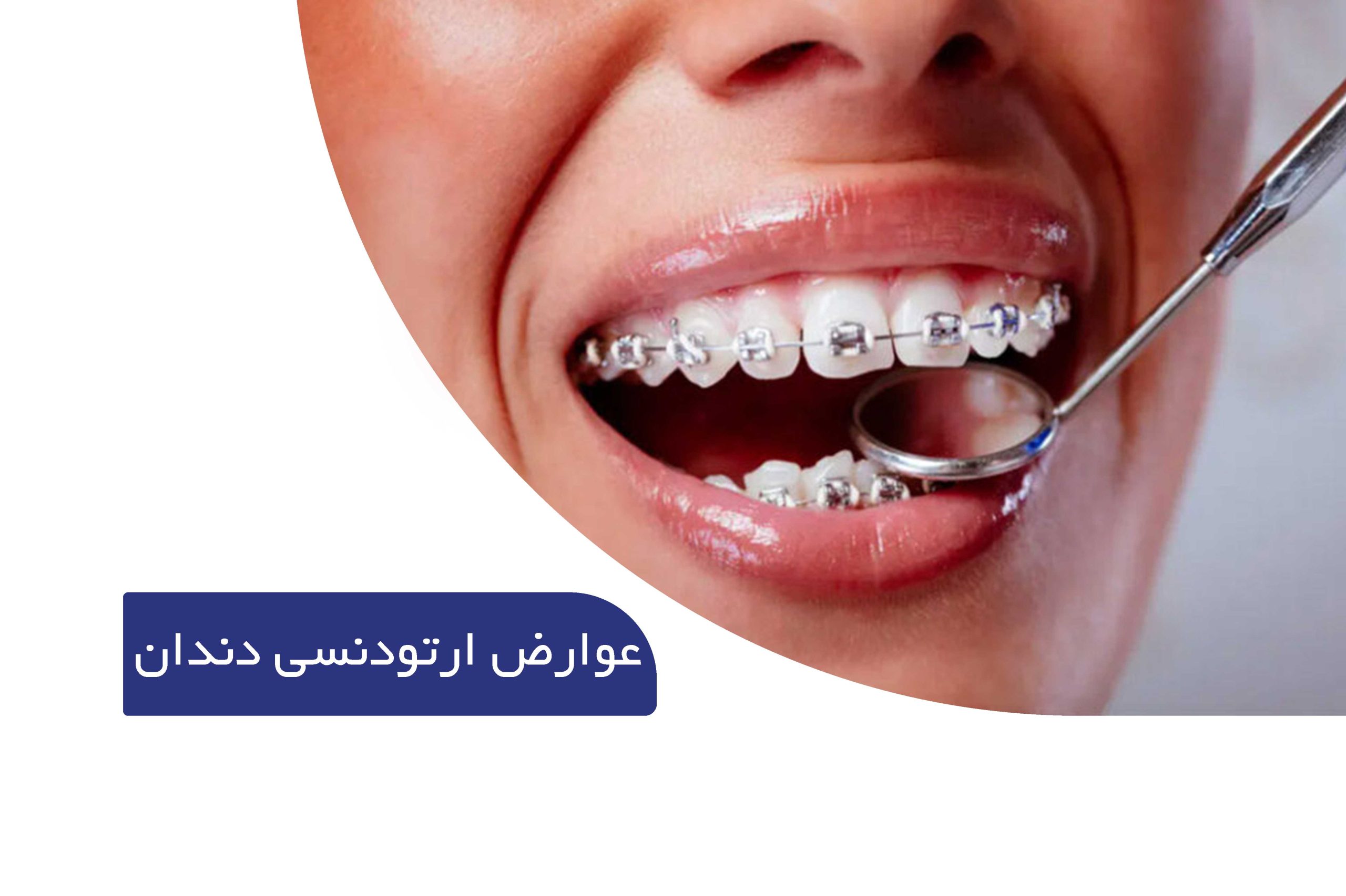 عوارض ارتودنسی در کودکان و بزرگسالان 1 عوارض ارتودنسی دندان