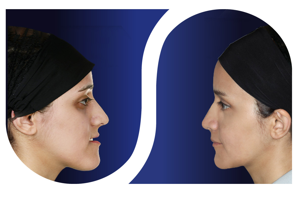 جراحی فک و ارتودنسی