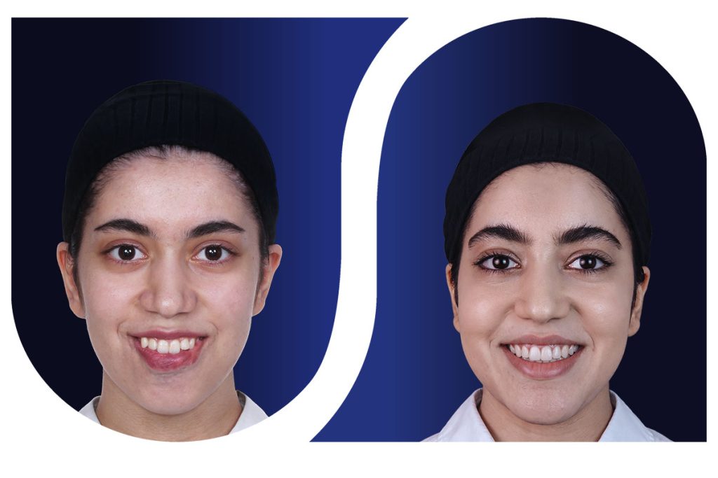 ارتودنسی و جراحی فک